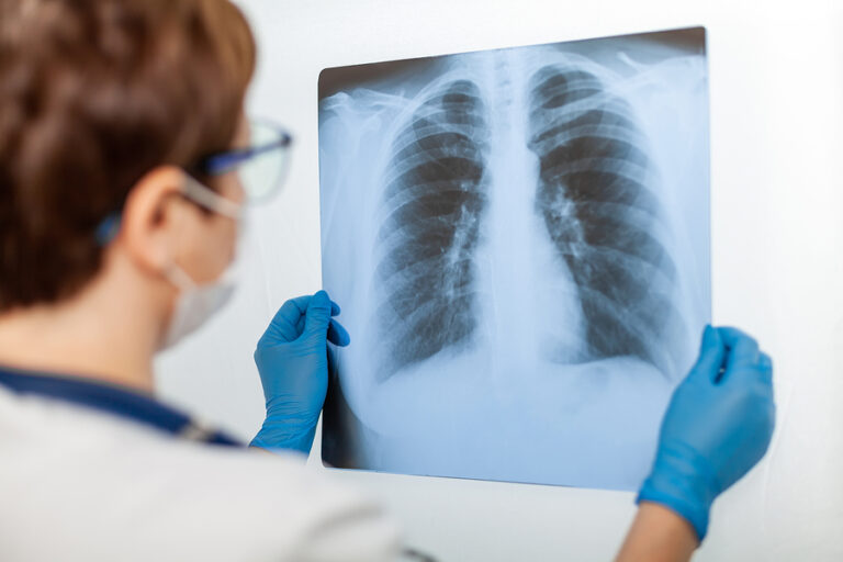 The Effects of Heroin on Your Lungs and Respiratory System